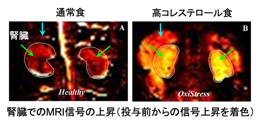 図５．量子センサーを投与して撮像したマウスの腎臓のMRI画像