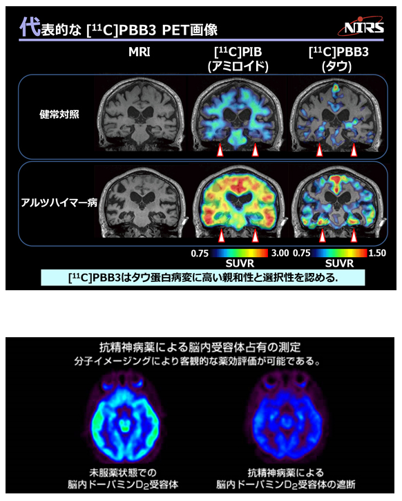 脳機能および精神・神経疾患の病態と治療評価に関する臨床研究の画像