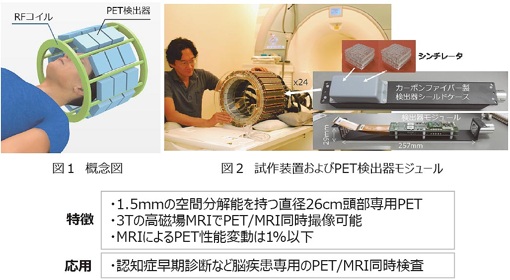 既存のMRI装置に後付けできる頭部専用PET