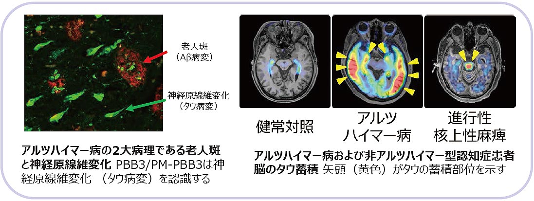 認知症の病態解明、診断法、治療法および創薬支援技術の研究開発