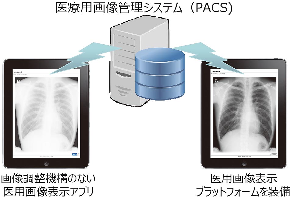 医用画像を最適な階調で表示可能とするプラットフォーム