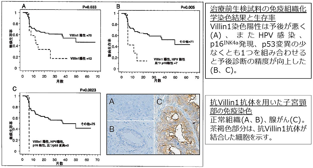 子宮頸部腺がんの診断・予後予測マーカー