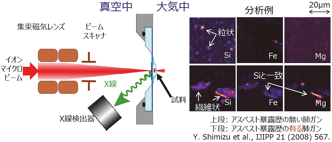 大気マイクロ粒子線励起X線放出による生体内微量元素分布分析