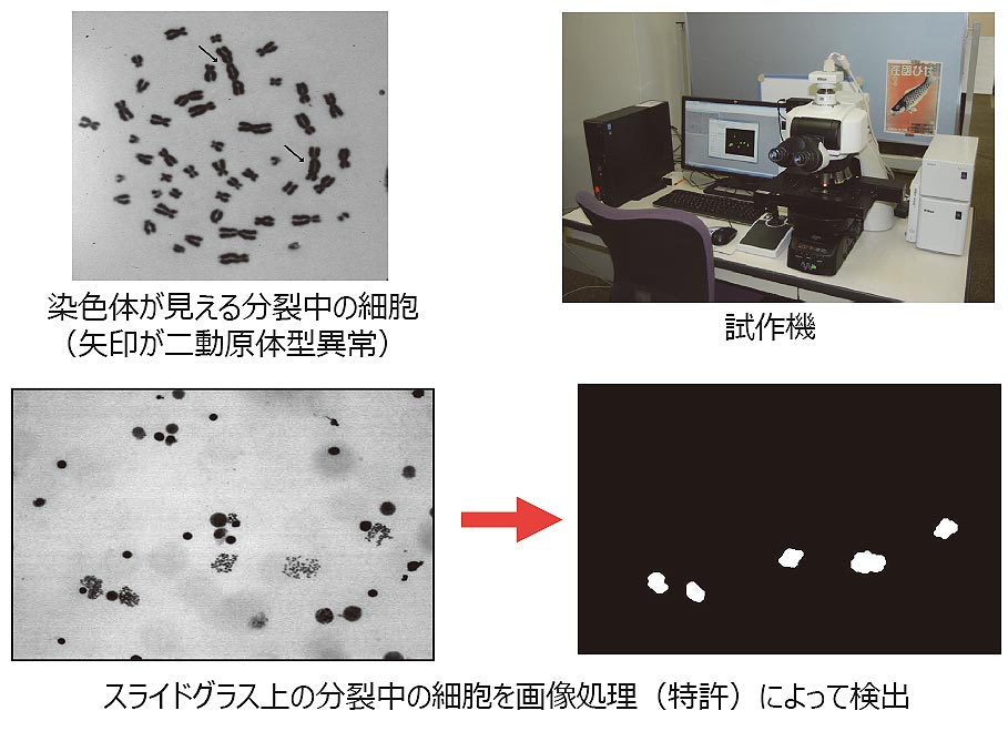 異常染色体自動検出装置