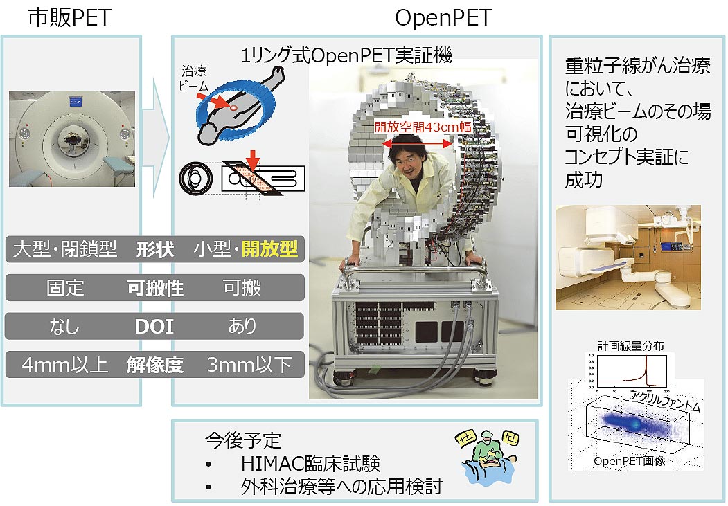 がんを見ながら治療:開放型PET装置