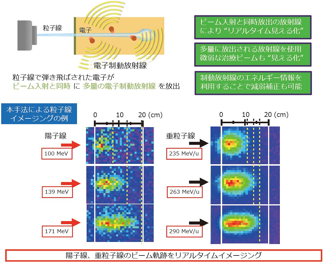 制動放射線計測による治療ビームイメージング技術の開発