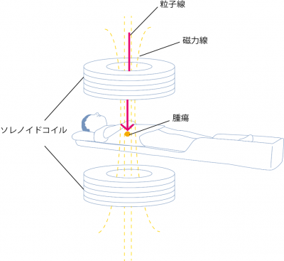 図4　粒子線治療時に、粒子線の進行方向と平行な外部磁場を掛けるイメージの例