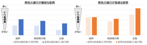 図２　病気の進行の速さと脳内タウ蓄積との関連