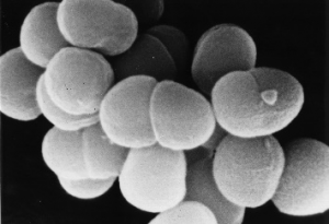 放射線に強い細菌の謎に迫る～放射線により生じたDNAの傷を治すタンパク質の機能を解明～