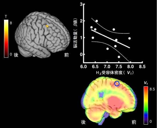 作業記憶に関わる外側前頭前野の脳活動とヒスタミンH3受容体密度との負の相関関係の画像