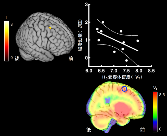 頭の回転の速さ に脳内ヒスタミンが関与 量子科学技術研究開発機構
