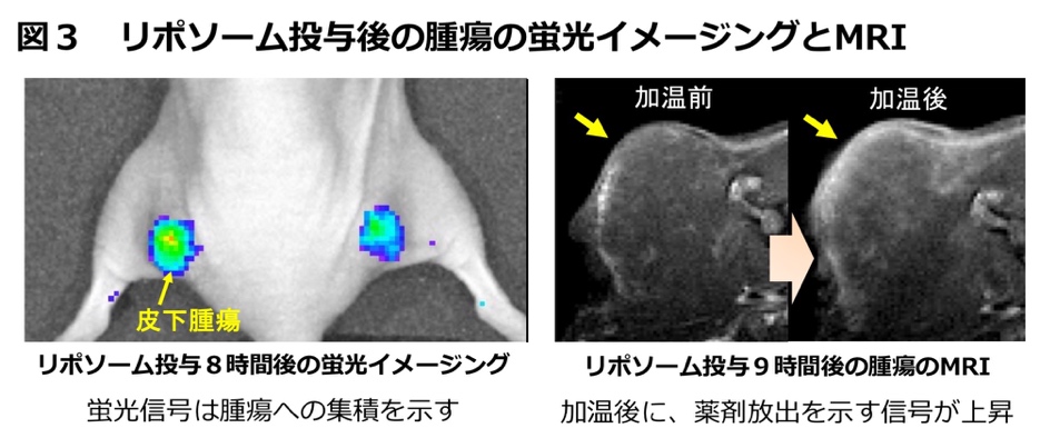 （図2）がん造影・治療リポソームを投与した後の腫瘍の蛍光イメージングとMRI