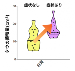 遅発性脳障害の症状の有無で比較したタウ蓄積量