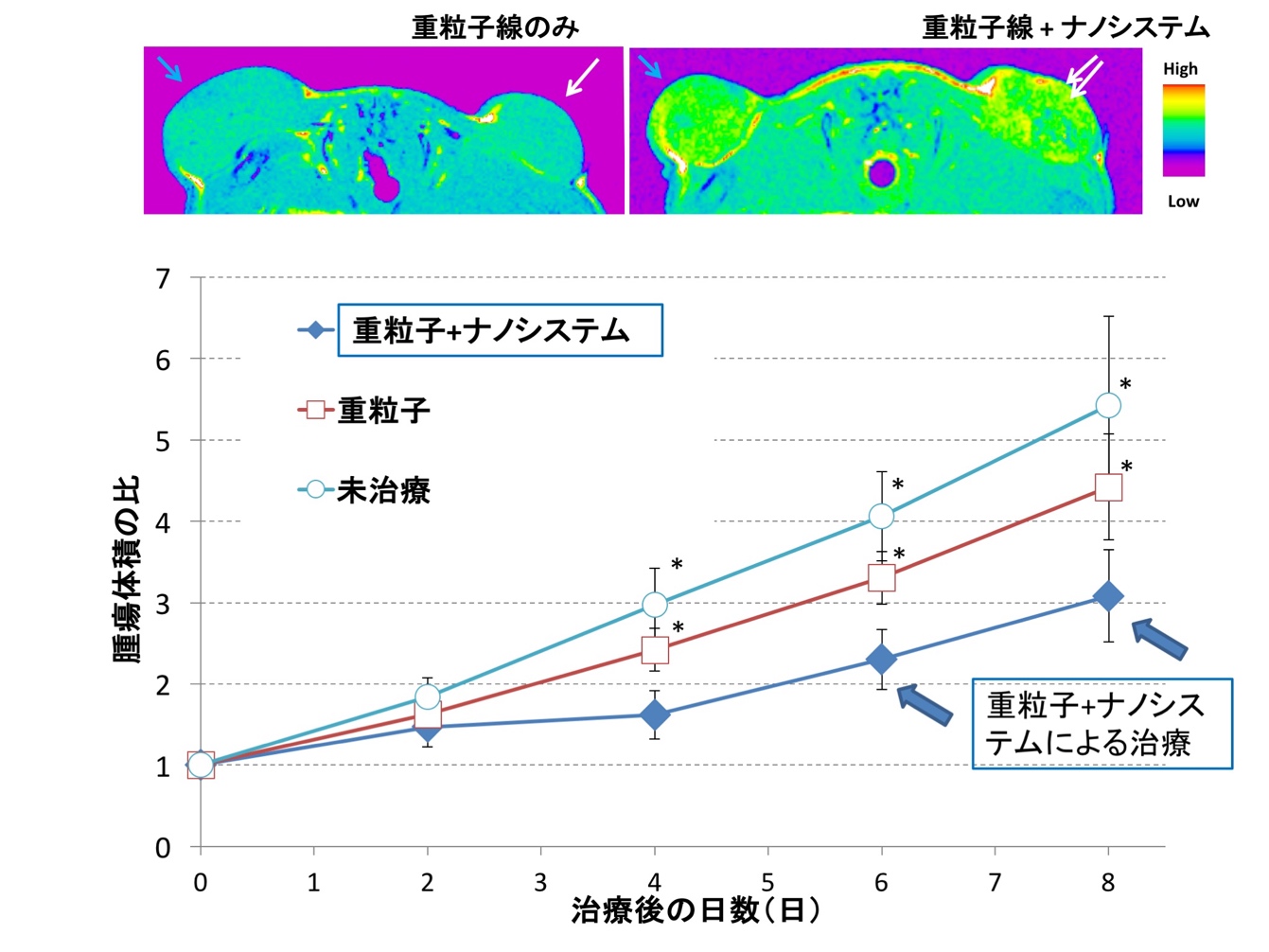 （図3）重粒子線治療単独の場合と、がん造影・治療リポソームによるナノ薬剤送達システム併用治療との効果の比較