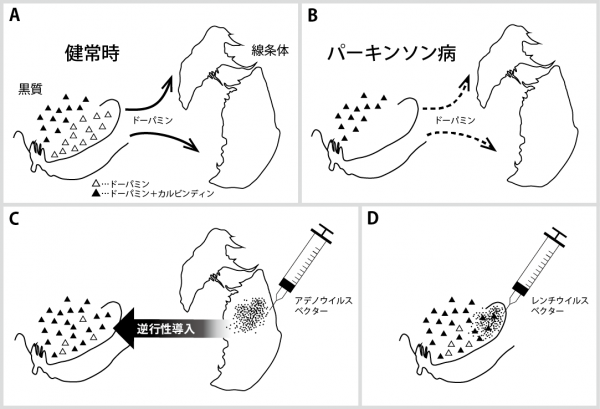 本成果は、2018年8月中に米国の国際学術誌「Movement Disorders」にオンライン掲載されますの画像