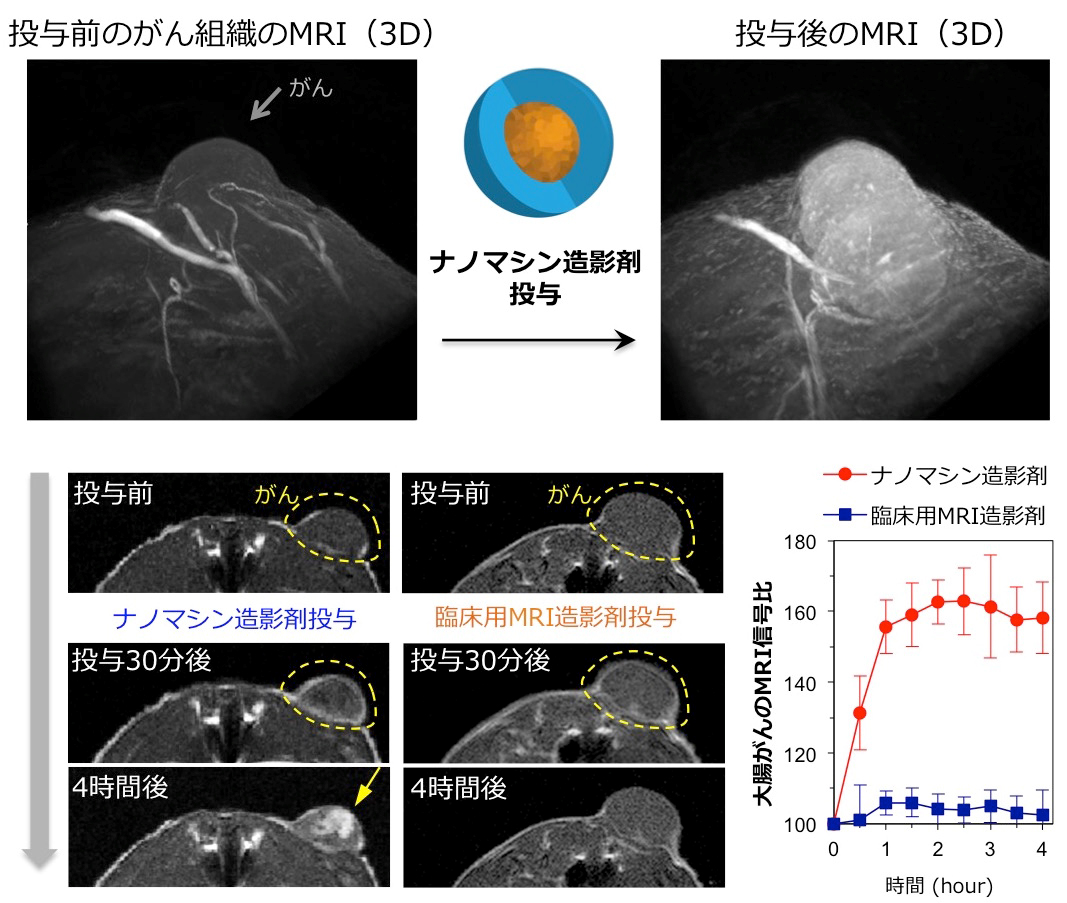 図1.ナノマシン造影剤を投与して撮像したMRI像