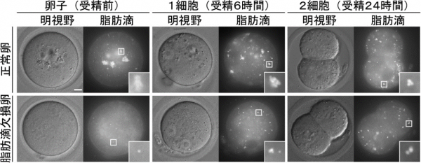 受精卵の発育には適量の脂肪が必要 マウス卵子から脂肪滴を除去する技術の開発により解明 量子科学技術研究開発機構