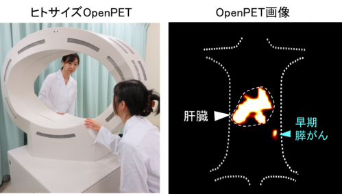 64Cu-セツキシマブ腹腔投与によるOpenPETイメージング