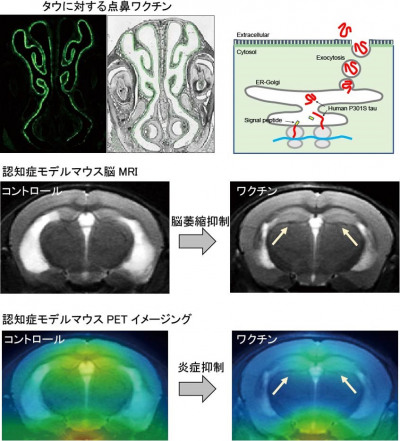 タウに対する点鼻ワクチン抑制の様子