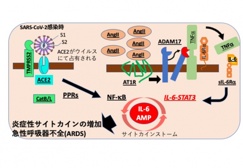 SARS-CoV-2感染時に、気管支・肺胞上皮細胞でのIL-6アンプが活性化し、その後の過剰なサイトカイン産生と急性呼吸器不全症候群(ARDS)を誘導する模式図