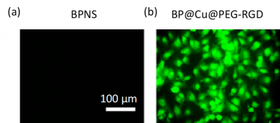  黒色腫がん細胞に(a) BPNS または(b) BP@Cu@PEG-RGDを添加した後の黒色腫がん細胞内の活性酸素（ヒドロキシルラジカルなど）の測定結果（緑蛍光は活性酸素）