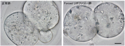 Forcedリポファジー卵の脂肪滴の変化の画像