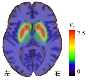 図3　線条体におけるドーパミンD2受容体のPET画像の画像
