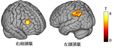 図4　fMRIで計測した脳活動データ​の画像