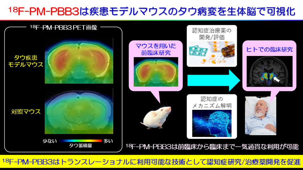 18F-PM-PBB3はトランスレーショナルに利用可能な技術