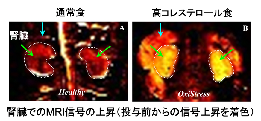 図5．量子センサーを投与して撮像したマウスの腎臓のMRI画像