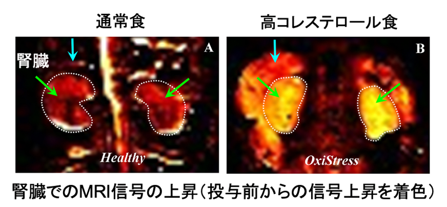 図5.量子センサーを投与して撮像したマウスの腎臓のMRI画像