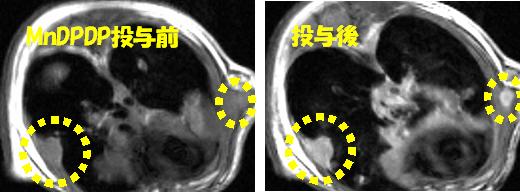 ＭｎＤＰＤＰ造影ＭＲＩにより検出したマウス微小中皮腫