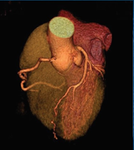 世界で初めて描出された鼓動する心臓（2005年、東京女子医科大学との共同研究）の画像1