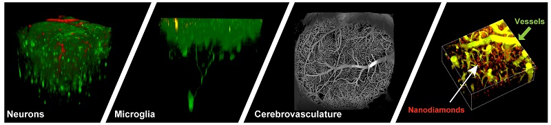 Quantum Neuromapping and Meuromodulation Group Fig.