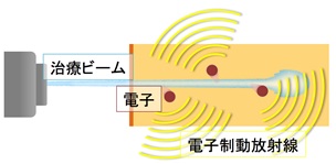 電子制動放射線発生の模式図