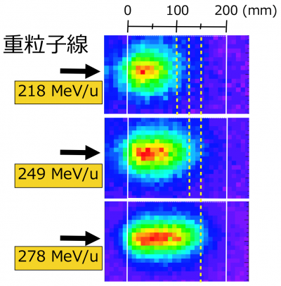 図2　飛跡の長さが98 mm, 123 mm, 149 mmとなるようエネルギーを調整した3つの治療ビームを、放射線イメージング装置により測定し得られた画像の画像