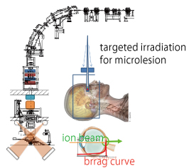 Microsurgery system