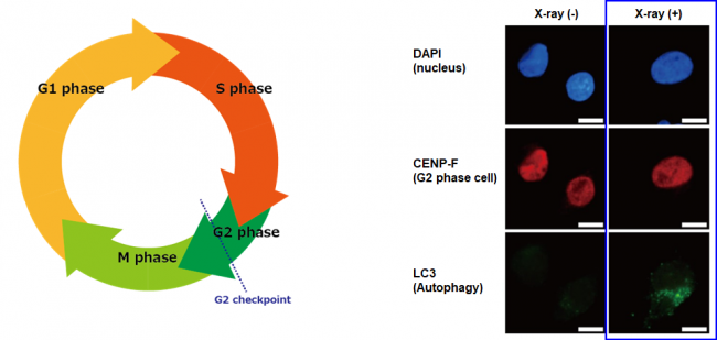 Cell cycle and autophagy induction after X-ray irradiation in human pancreatic cancer cells (MIA PaCa-2)