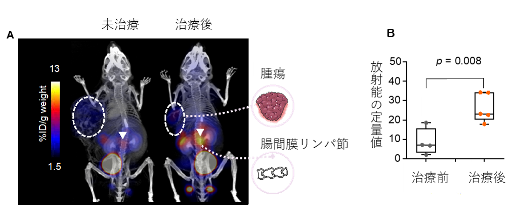 未治療と治療後の担癌マウスの全身PETイメージング画像(A)及び腸管膜リンパ節における放射能の定量値(B)