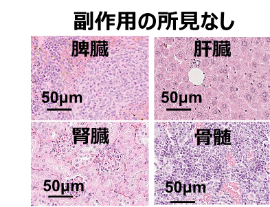  225Ac標識NZ-16投与マウスの病理像