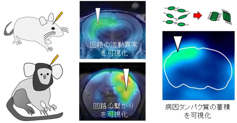 脳深部の回路に導入された脳内レポーターを目印に回路の繋がりや活動異常、病因タンパク質の蓄積の最初期を生体イメージング