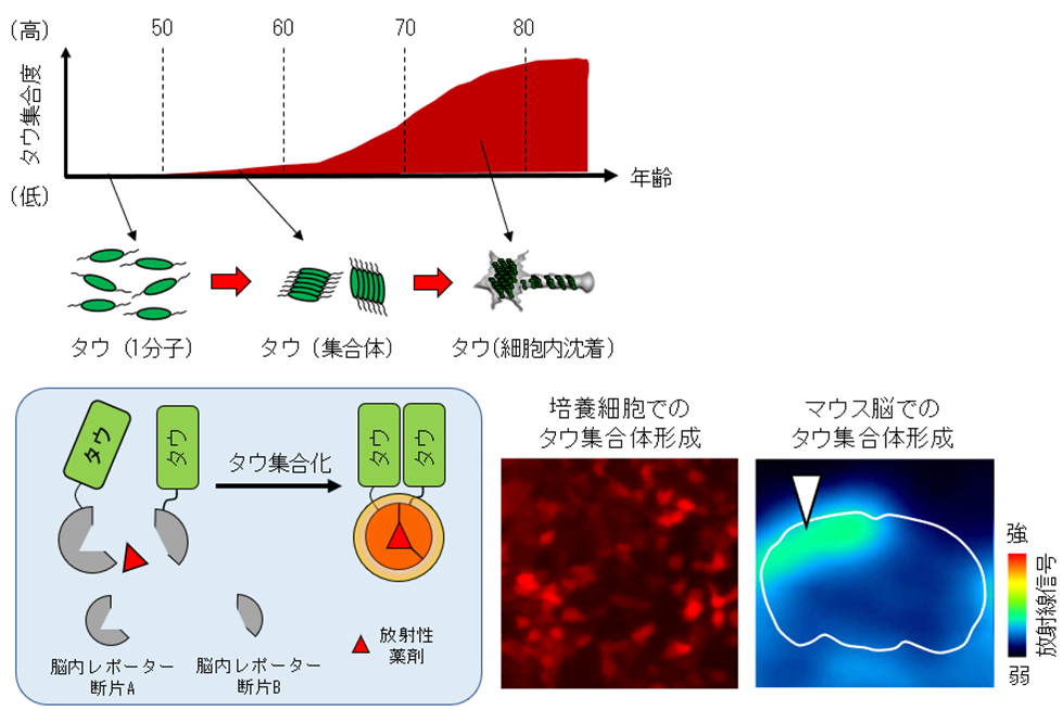 回路におけるタウ集合体形成を放射光で早期検出