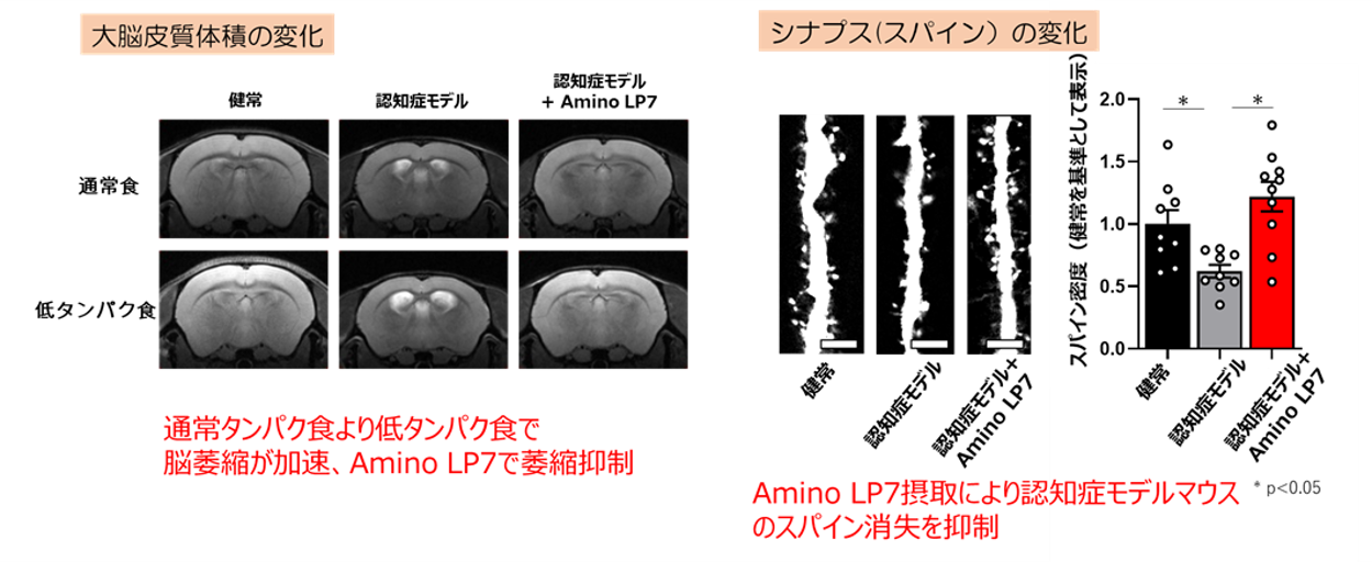 Amino LP7摂取による大脳皮質の萎縮の抑制およびシナプス(スパイン)消失の抑制