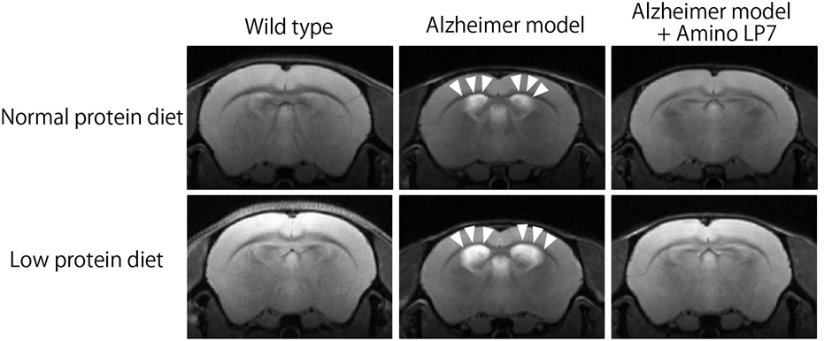 Brain magnetic resonance images showing the effects of Amino LP7 and diet on brain atrophy