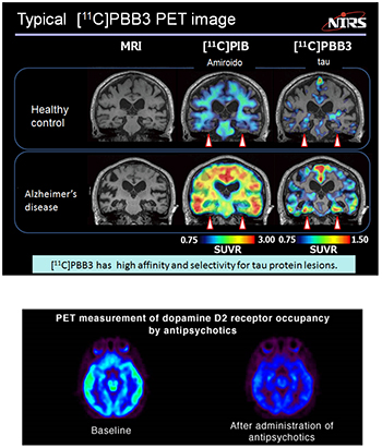 Clinical research on the pathology and therapy evaluation 