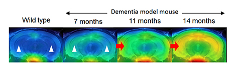 PET image of a mouse brain (coronal plane) after administration of TSPO ligand 