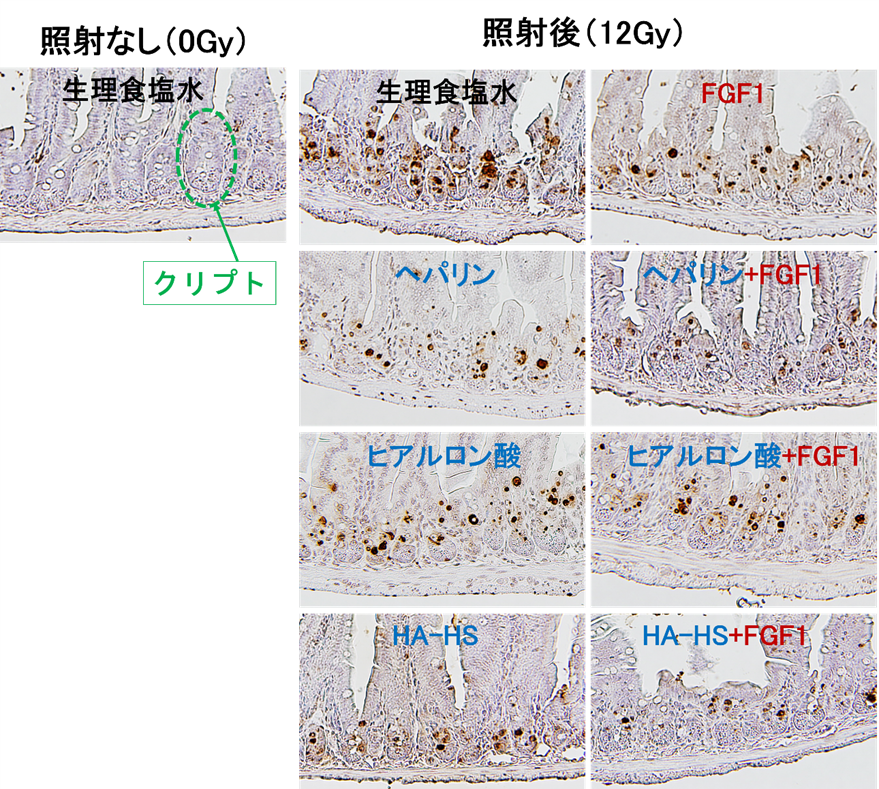 放射線誘発性の細胞死に関する解析