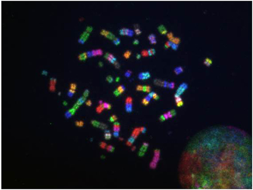 Complicated chromosomal rearrangements in a 20-Gy irradiated human peripheral blood lymphocyte (M-FISH) photo
