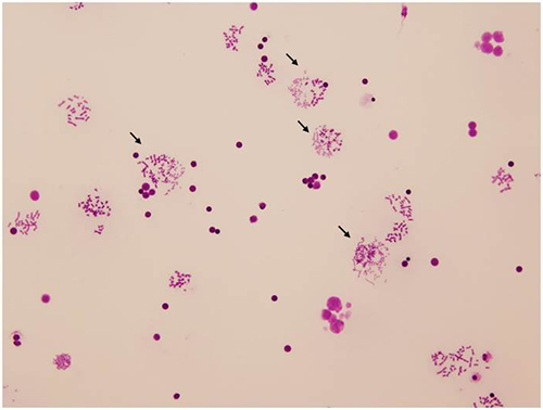 Hybrid cells with prematurely condensed human chromosomes by conventional Giemsa-staining (arrows) photo1
