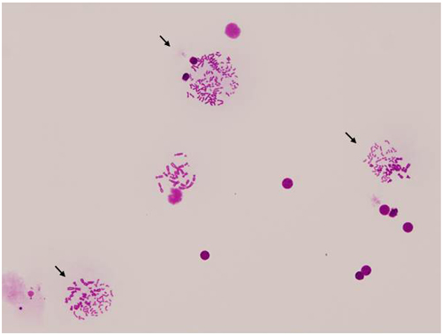 Hybrid cells with prematurely condensed human chromosomes by conventional Giemsa-staining (arrows) photo2